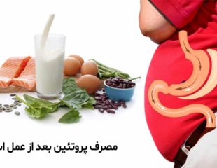 مصرف پروتئین بعد از عمل اسلیو معده