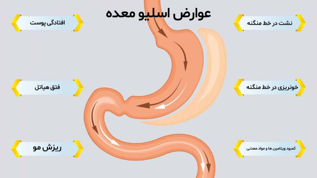بعد از تزریق چربی صورت چه ویتامین‌هایی بخوریم+عمل اسلیو چگونه باعث لاغری میشود+آیا اسلیو معده باعث نازایی می‌شود+عوارض اسلیو معده