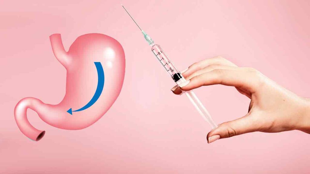 بوتاکس معده چیست؟ بوتاکس چگونه به لاغری کمک می کند؟ - dritm