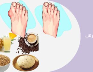 رژیم نقرس